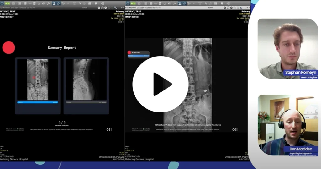 RBfracture product review by Health AI Register